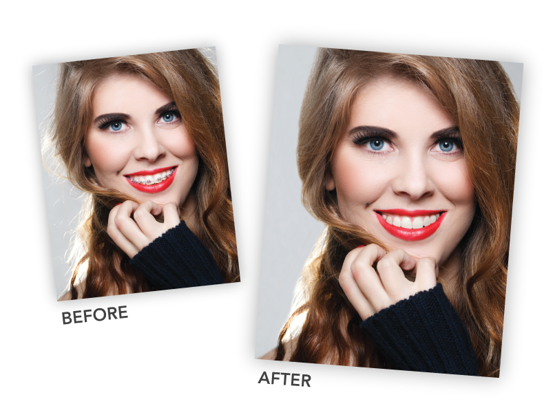 Retouching for Flawless Images